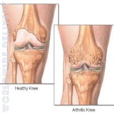 arthritis medicine online