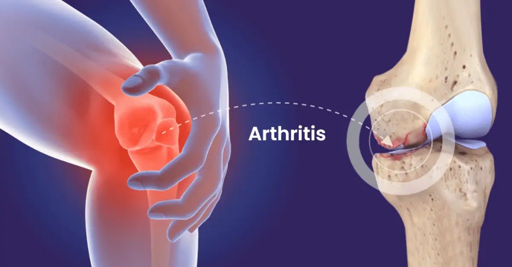 arthritis medicines online