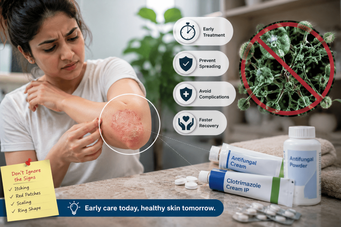Why Early Treatment is Important for Fungal Skin&nbsp;Infections?